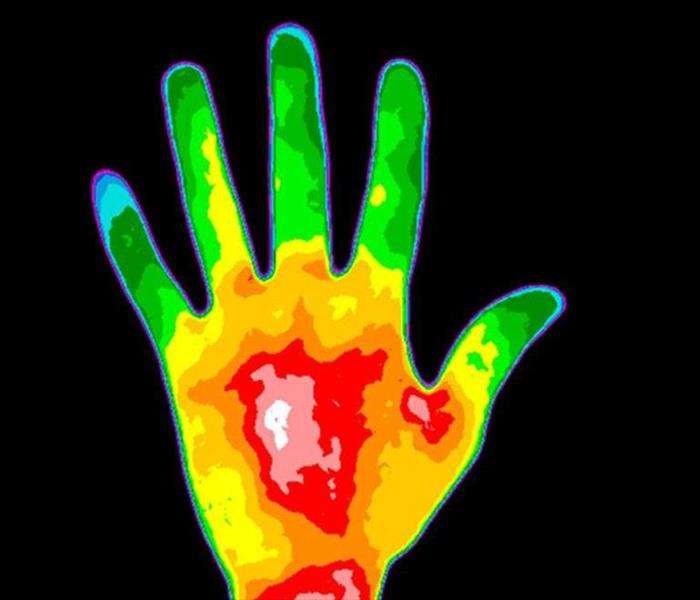 Thermal image of hand
